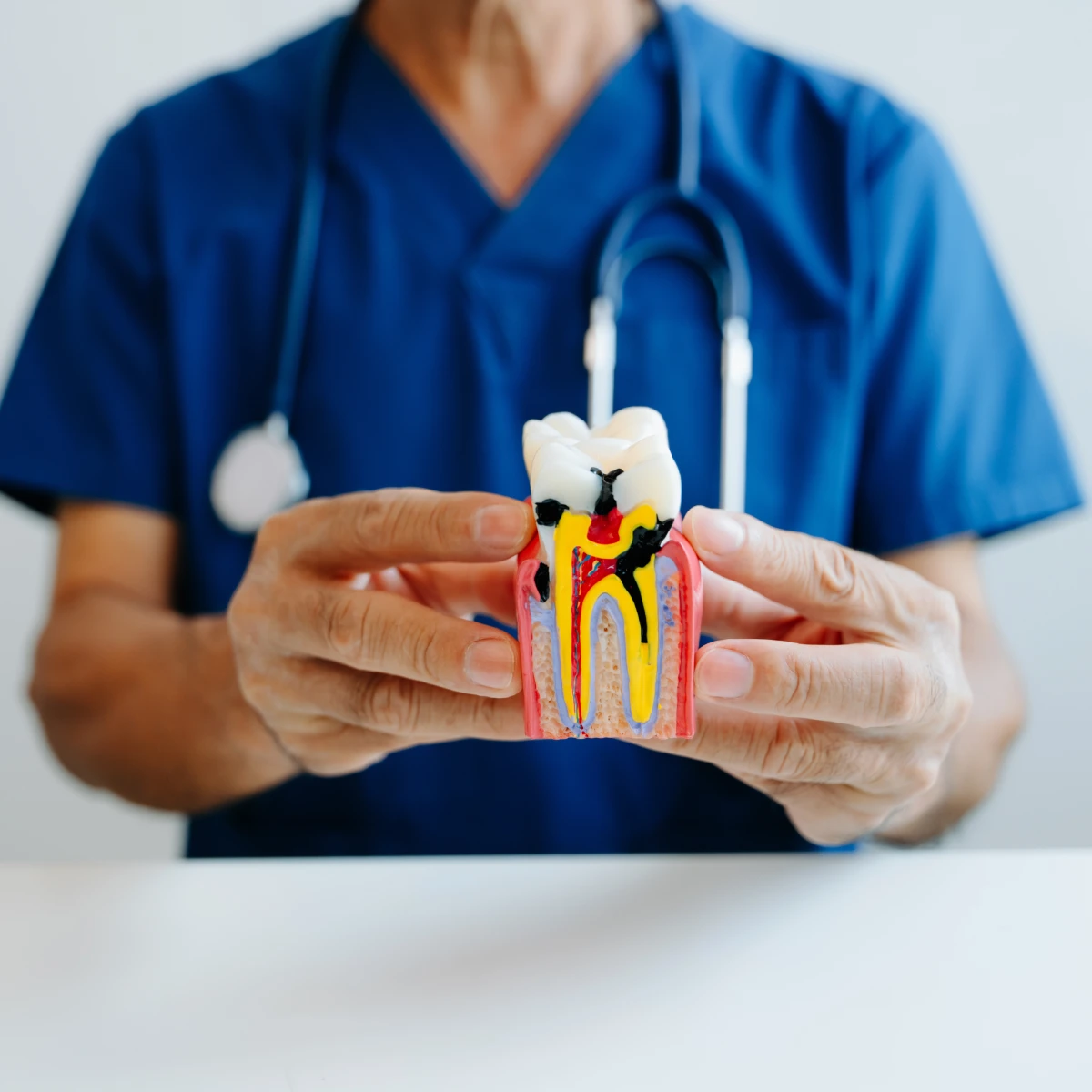 Descubre ¿Qué es la endodoncia? y los beneficios de tratarte en Promta.
